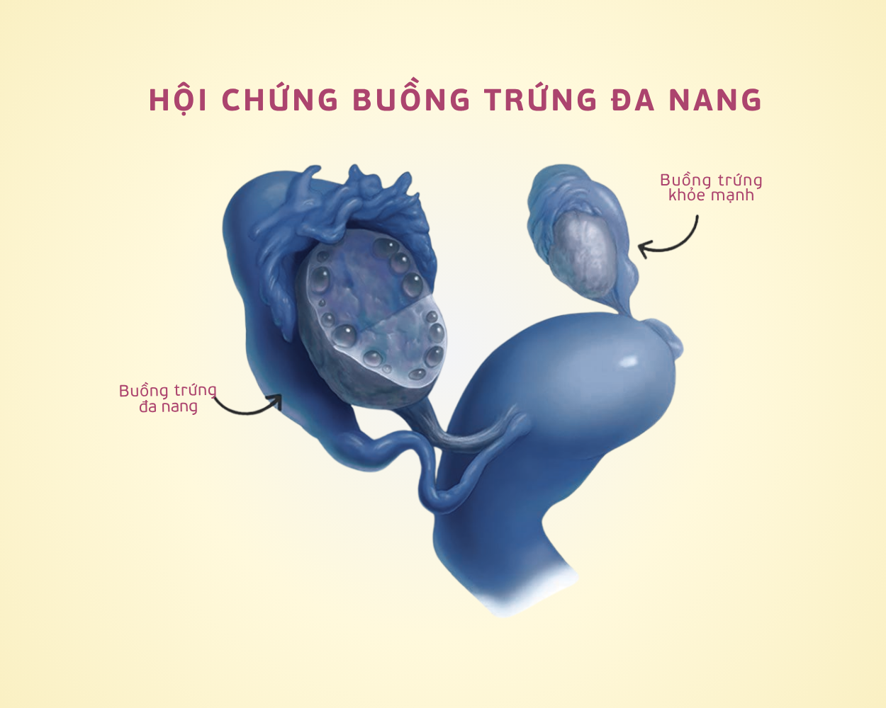 Hoi Chung Buong Trung Da Nang