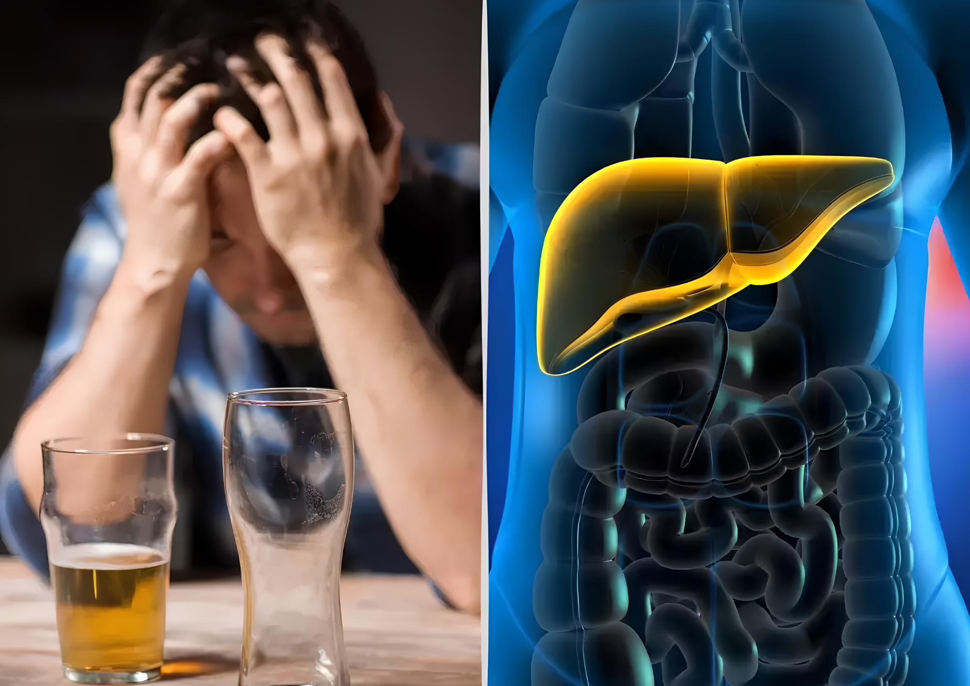 3. Dấu Hiệu Cảnh Báo Gan Bị Tổn Thương Do Uống Rượu Bia Thường Xuyên